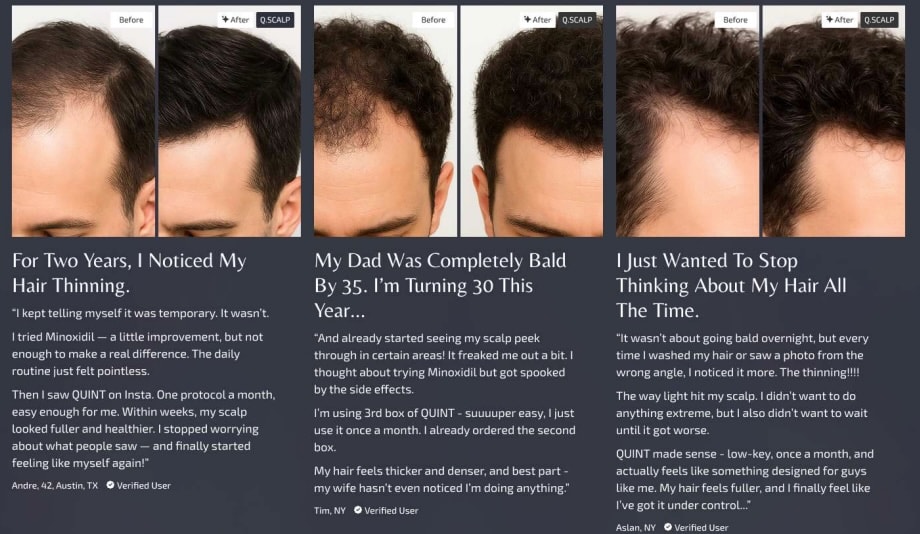 Supplied before and after Q.Scalp user examples